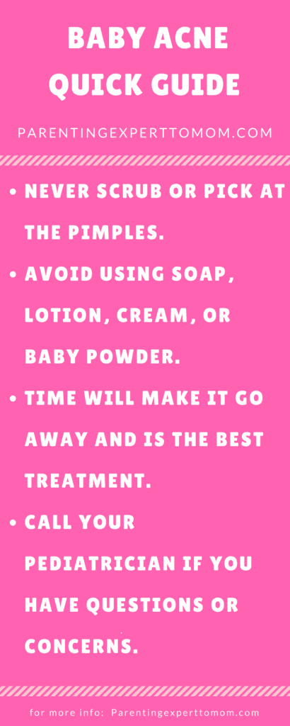Baby acne treatment quick guide