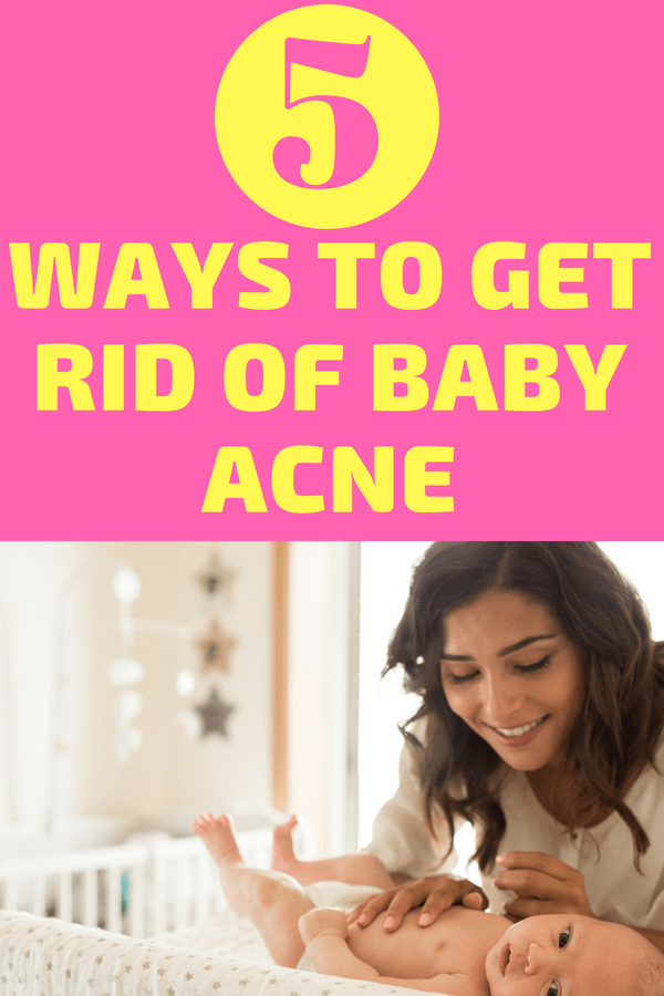 What causes baby acne? Find out the answer to this common question and more. Simple ways to keep your newborns skin clear and how to get rid of baby acne if it shows up. How to prevent baby acne so you don't have to deal with it.